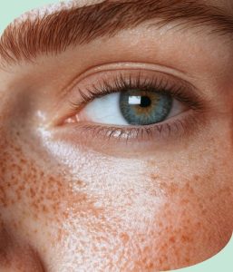 como quitar ojeras como quitar ojeras