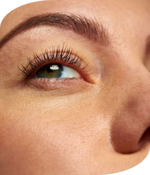 arrugas ojos